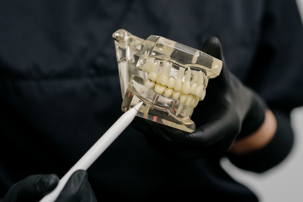 zahnarzt-maxvorstadt- implantat