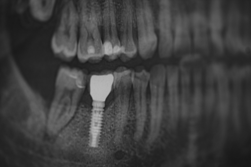 zahnarzt-maxvorstadt- dsc01928alexeytestov